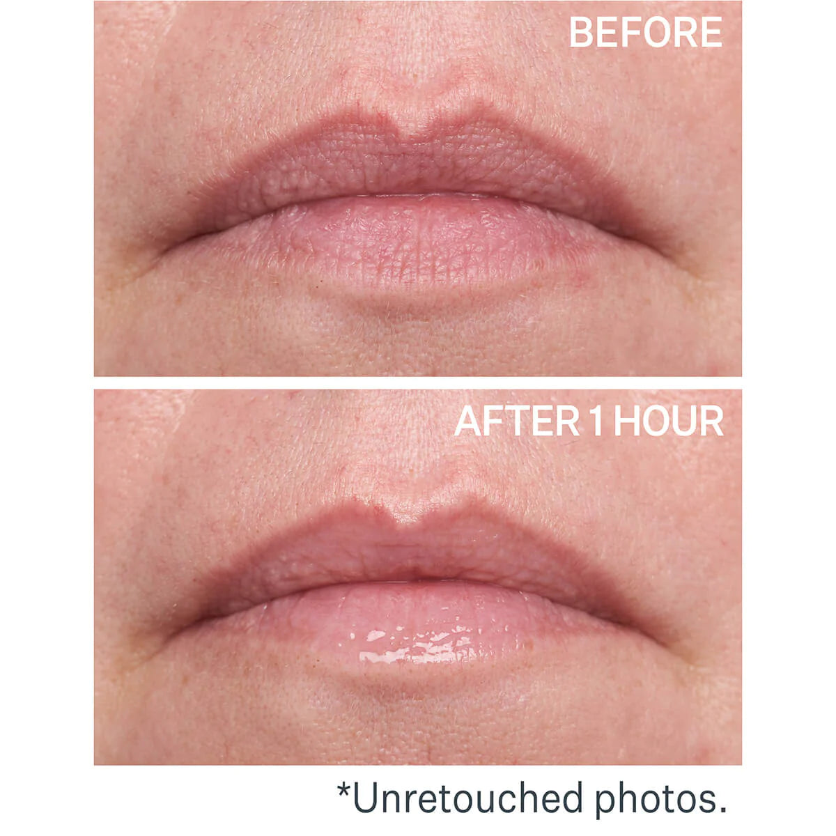 STRIVECTIN PLEJENDE LÆBEBALM MED HYALURONSYRE - 10 ML